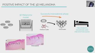 Scientific solutions for the gap in translational medicine: skin model platform with melanoma (3D melanoma)